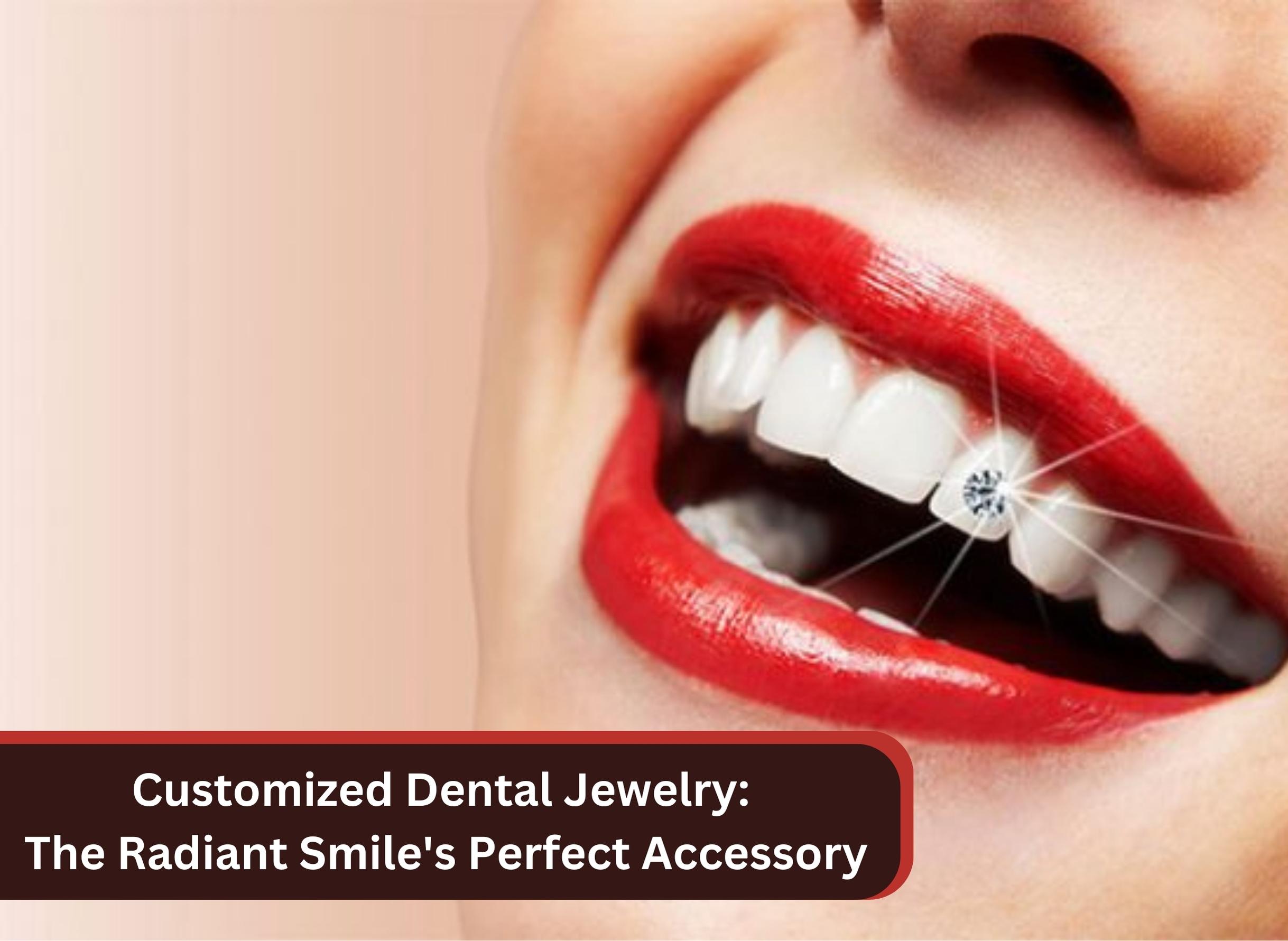 Customized Dental Jewelry: The Radiant Smile’s Perfect Accessory