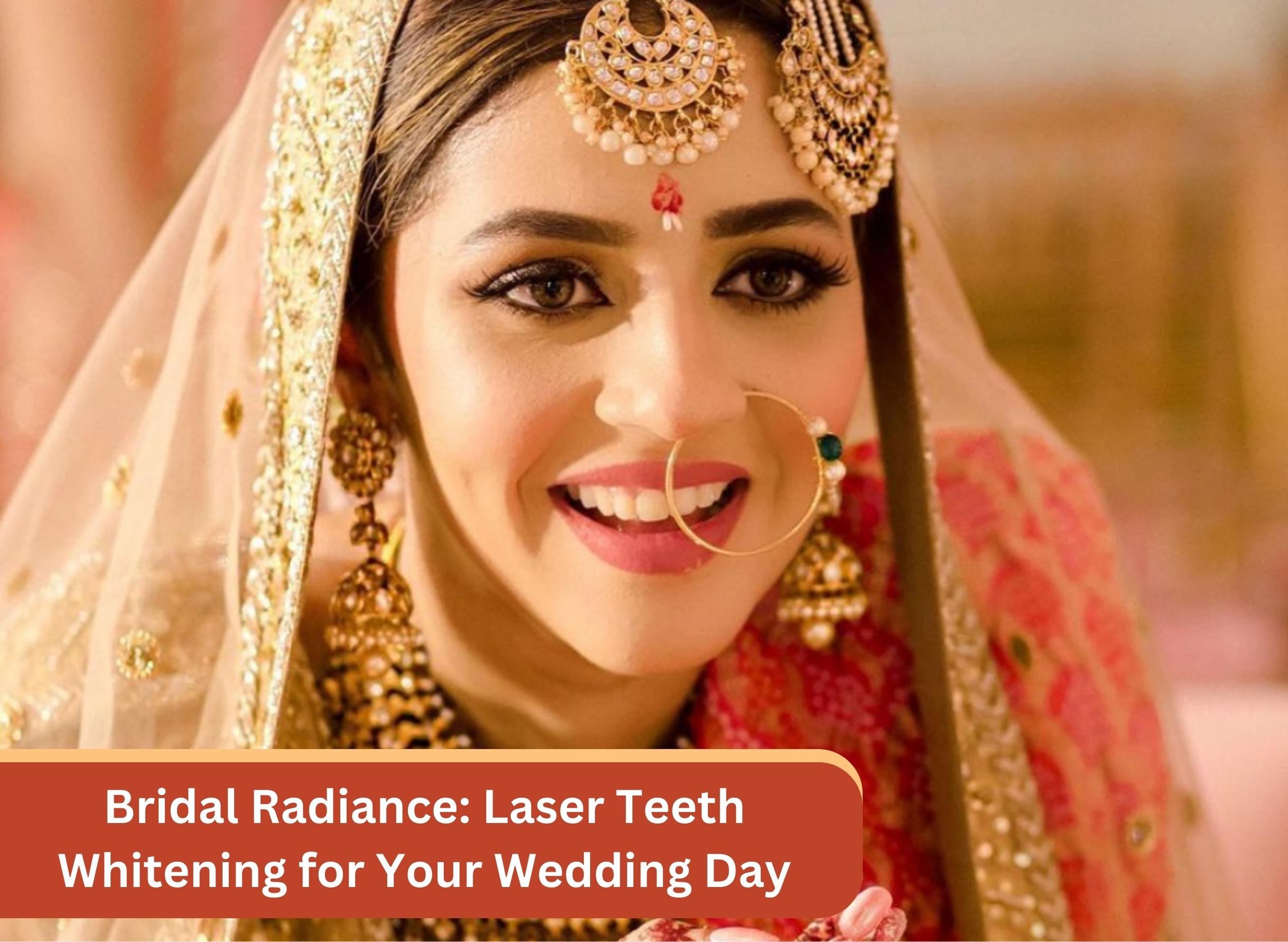 Bridal Radiance: Laser Teeth Whitening for Your Wedding Day