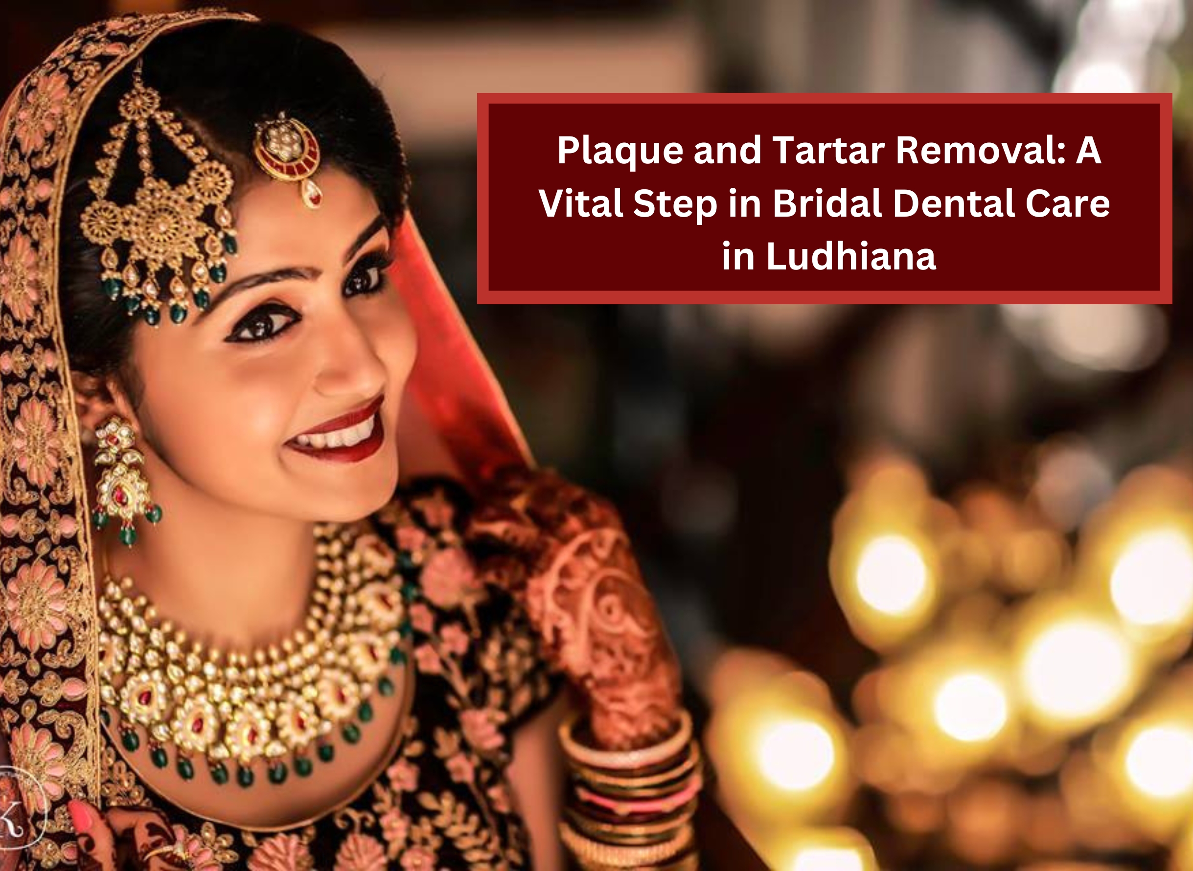 Plaque and Tartar Removal: A Vital Step in Bridal Dental Care in Ludhiana