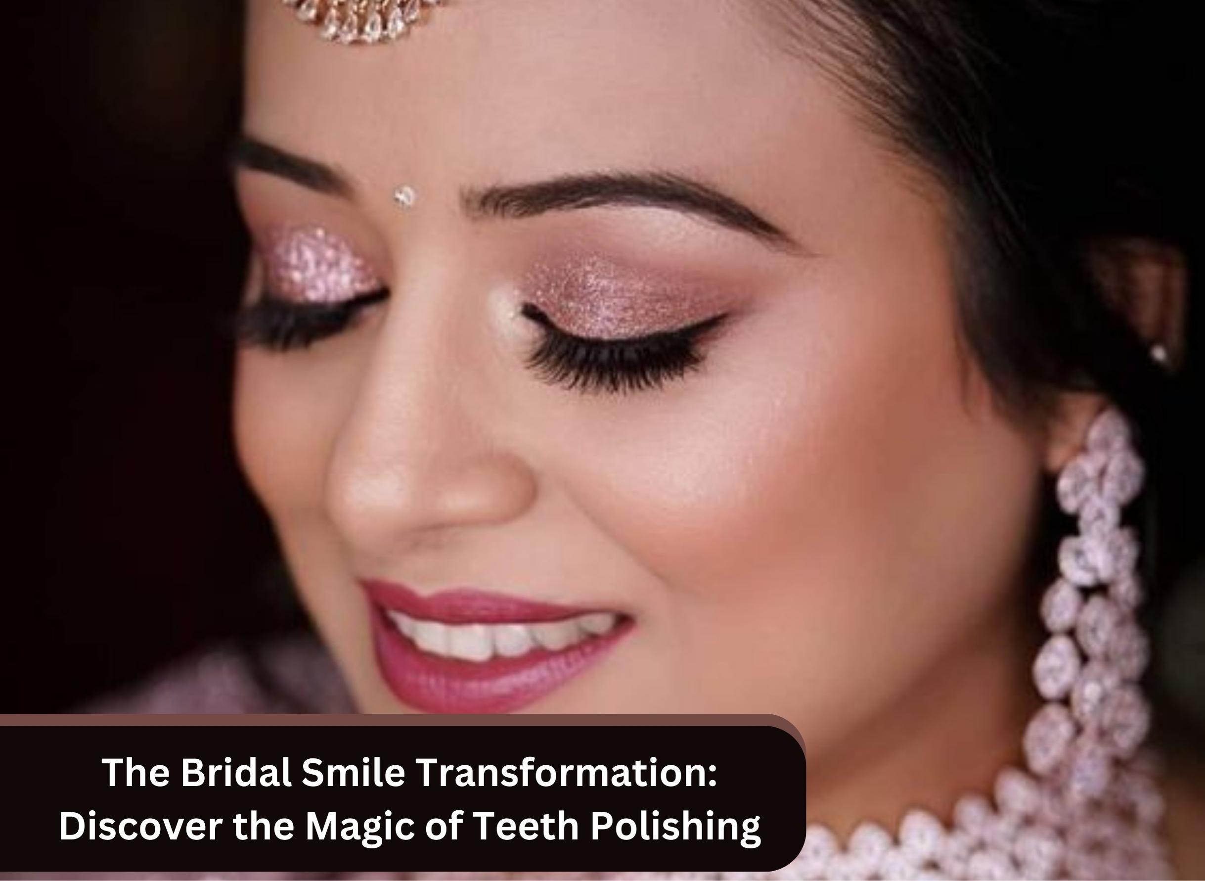 The Bridal Smile Transformation: Discover the Magic of Teeth Polishing