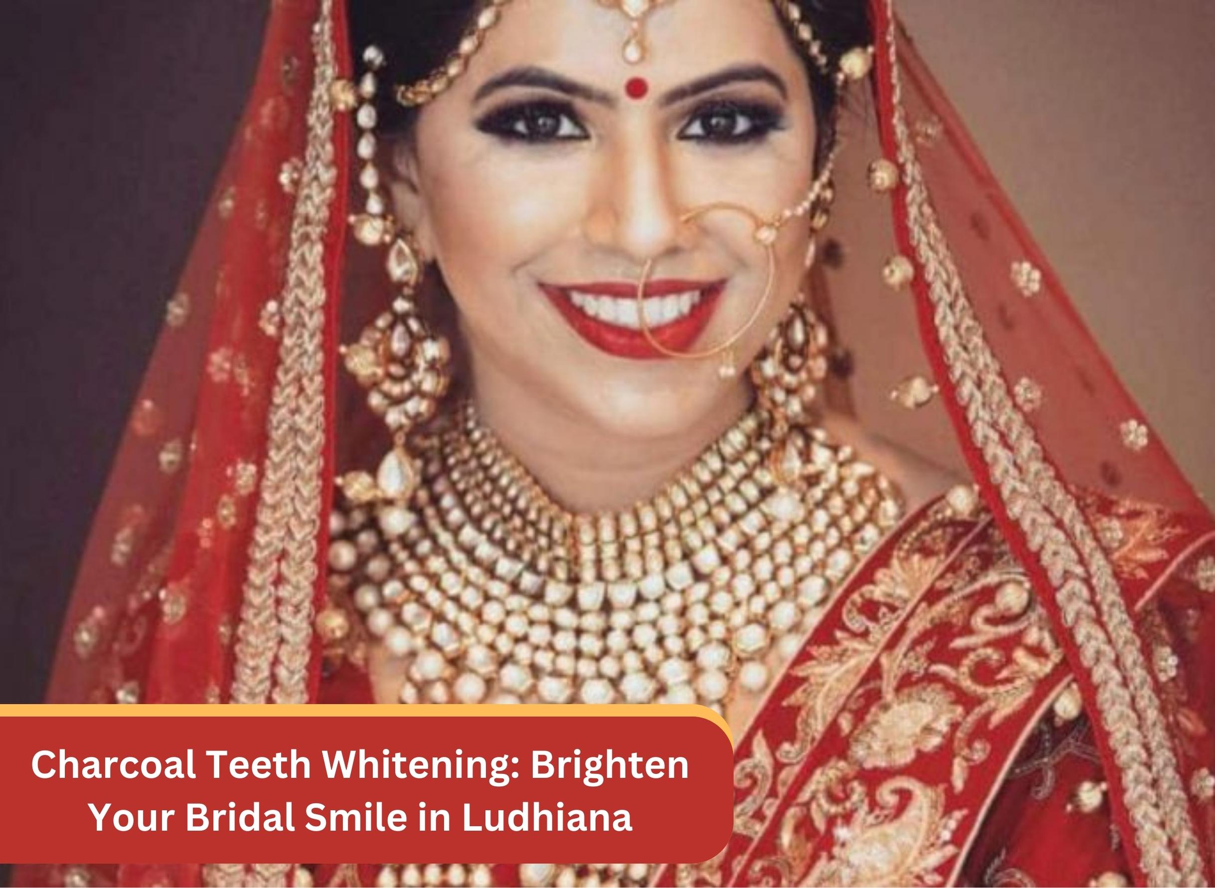 Charcoal Teeth Whitening: Brighten Your Bridal Smile in Ludhiana