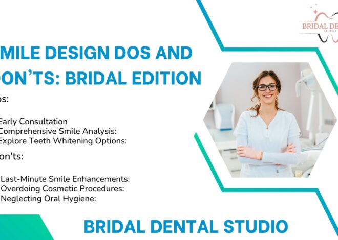 Smile Design Dos and Don’ts: Bridal Edition