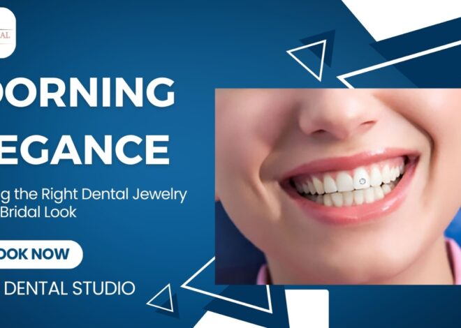 Adorning Elegance: Choosing the Right Dental Jewelry for Your Bridal Look