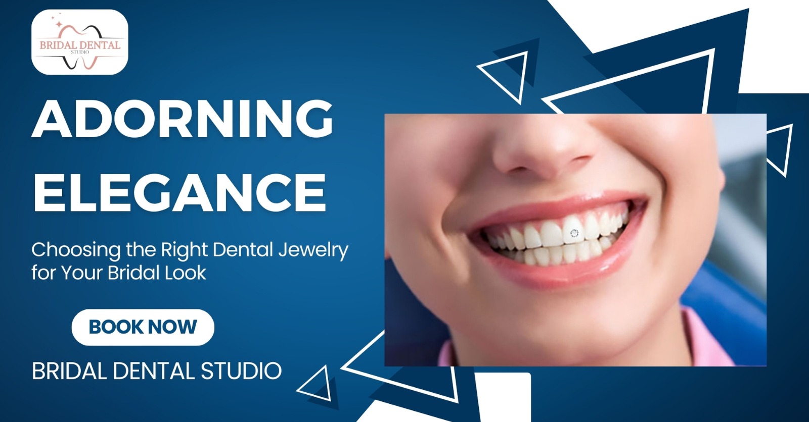 Adorning Elegance: Choosing the Right Dental Jewelry for Your Bridal Look