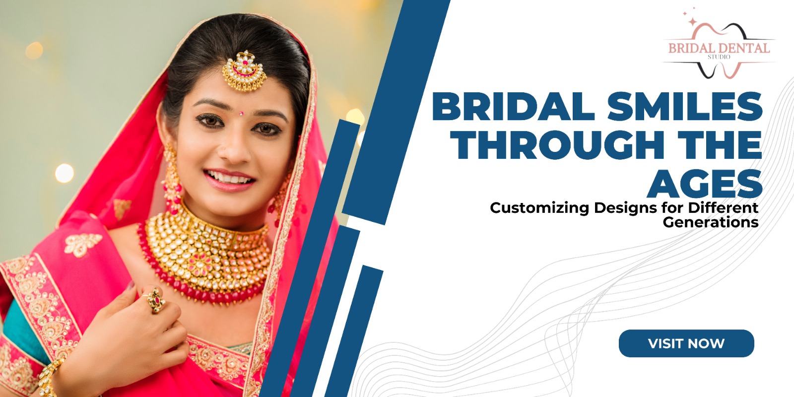 Bridal Smiles Through the Ages: Customizing Designs for Different Generations