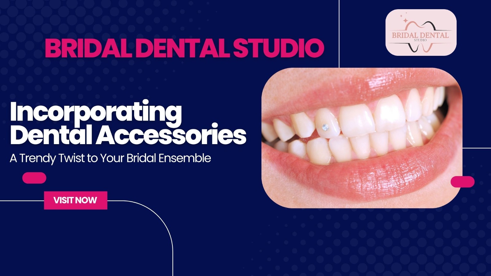 Incorporating Dental Accessories: A Trendy Twist to Your Bridal Ensemble