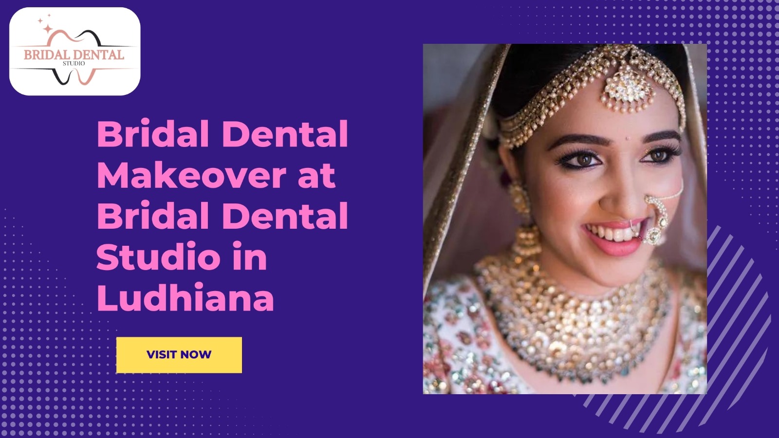 Bridal Dental Makeover at Bridal Dental Studio in Ludhiana