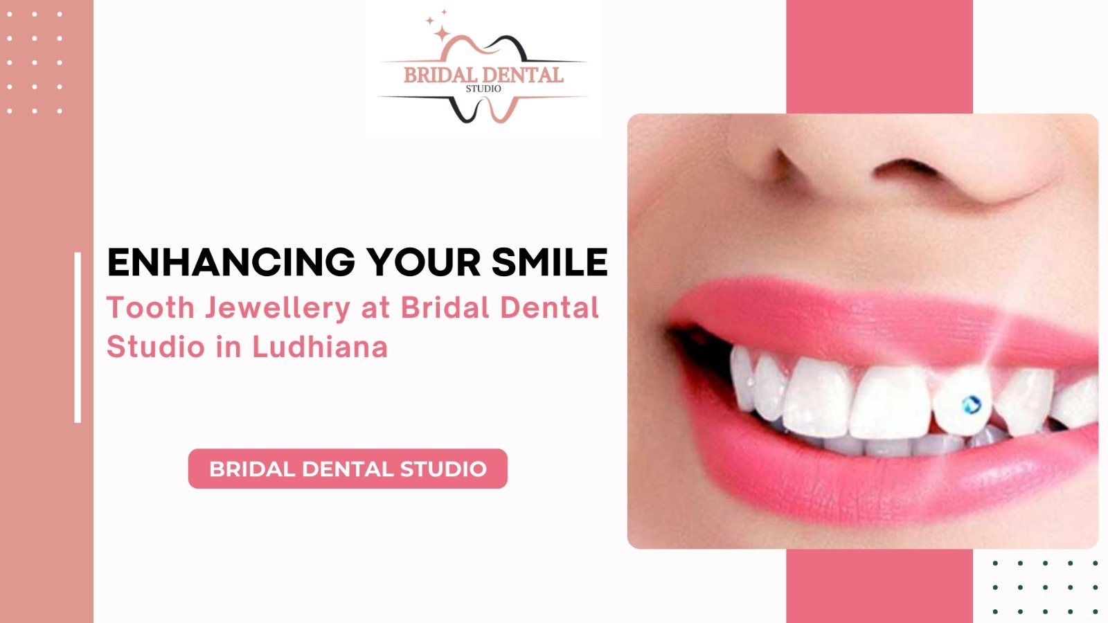 Enhancing Your Smile: Tooth Jewellery at Bridal Dental Studio Ludhiana