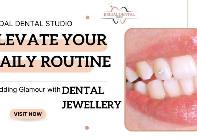 Elevate Your Daily Routine: Adding Glamour with Dental Jewelry