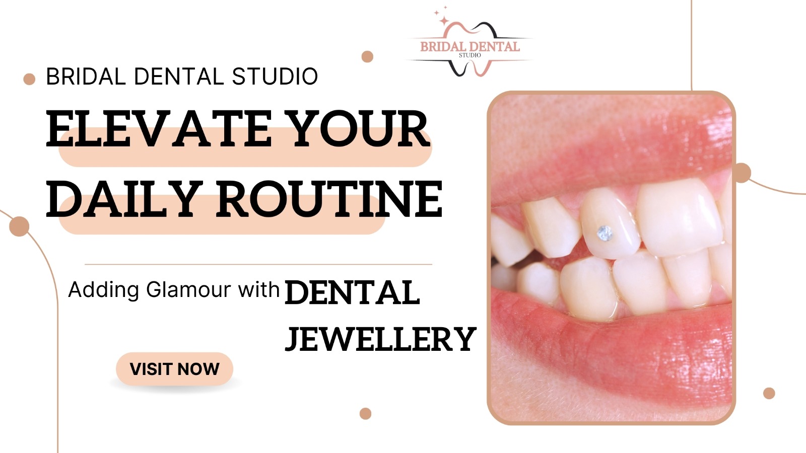 Elevate Your Daily Routine: Adding Glamour with Dental Jewelry