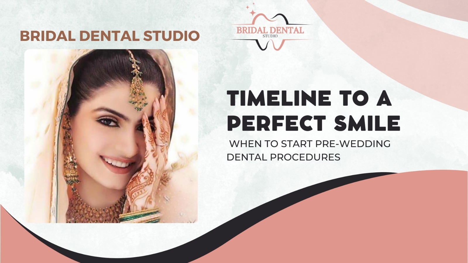 Timeline to a Perfect Smile: When to Start Pre-Wedding Dental Procedures